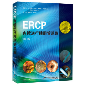 ERCP(ni)RđӰ